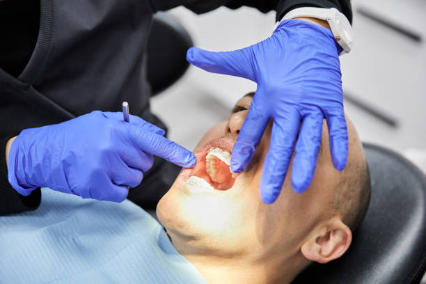 Best Emergency Dental Care for Abscessed Tooth in Aberdeen Proving Ground, MD