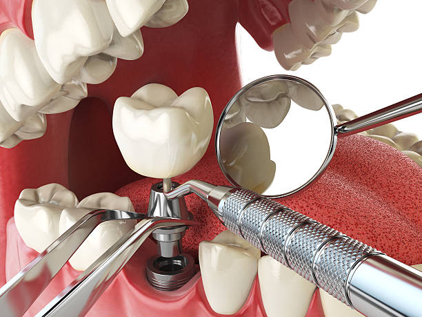 Best Emergency Cosmetic Dentistry in Aberdeen Proving Ground, MD
